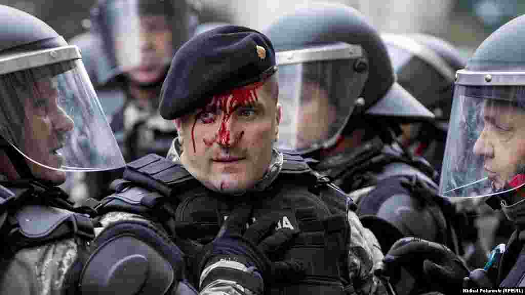 Un polițist sângerează după o ciocnire violentă cu veteranii de război în timpul unui protest din Sarajevo, Bosnia-Herțegovina, pe 5 septembrie. Câteva sute de veterani ai războiului din 1992-1995 au cerut mai multe beneficii și un catalog unificat al tuturor soldaților demobilizați. (Midhat Poturovic, RFE/RL)