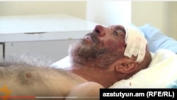 Ветеран Карабахской войны Смбат Акопян в больнице, 21 сентября 2015 г.
